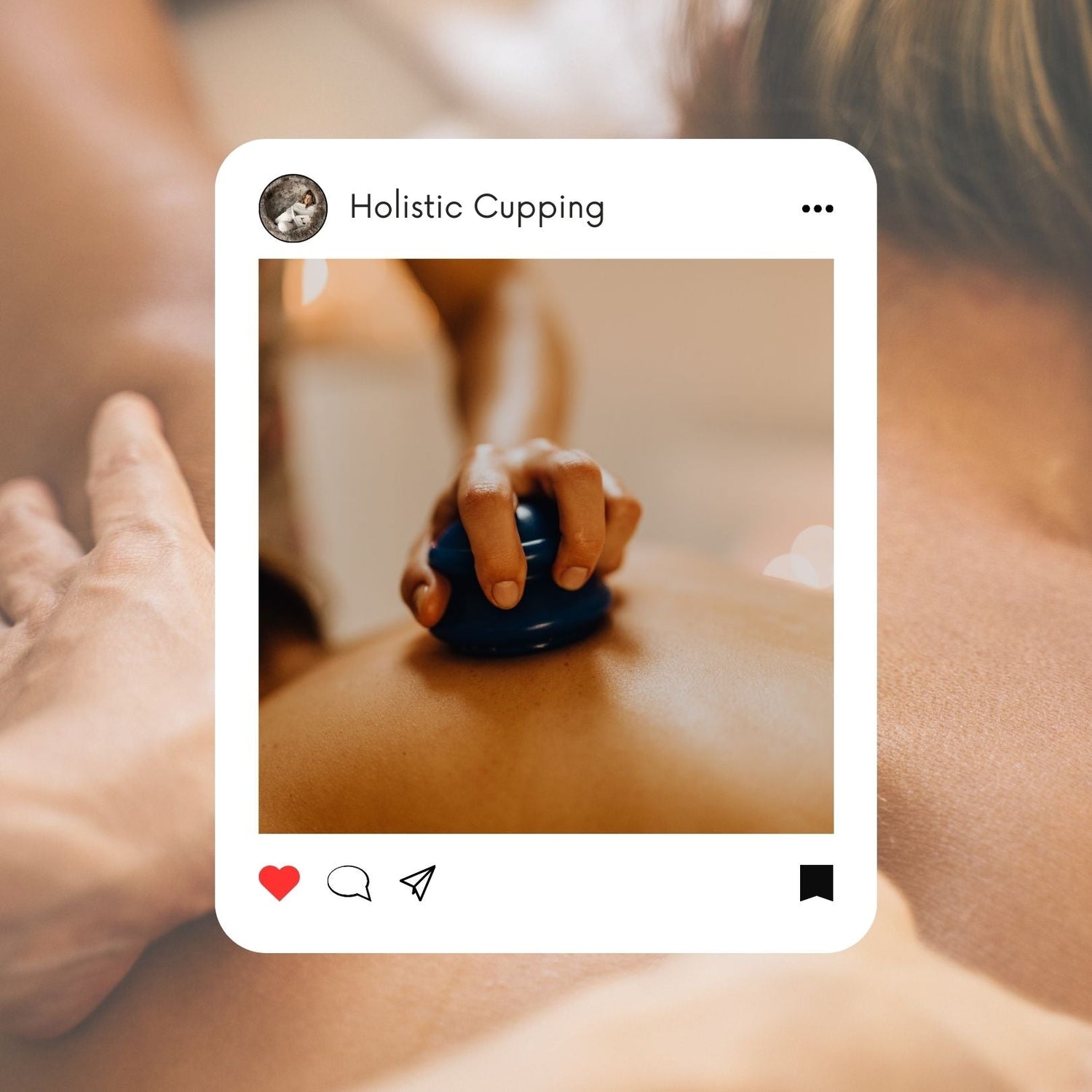 Holistic cupping